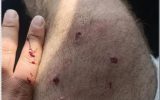 بحران سگ ها و فقدان عزم جدی برای حل مساله