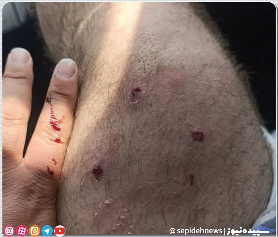 بحران سگ ها و فقدان عزم جدی برای حل مساله بحران سگ ها و فقدان عزم جدی برای حل مساله