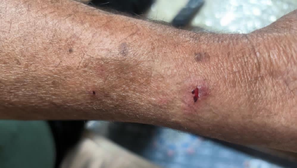 سگ از دست صاحبش رها شد و پدربزرگ و نوه را زخمی کرد